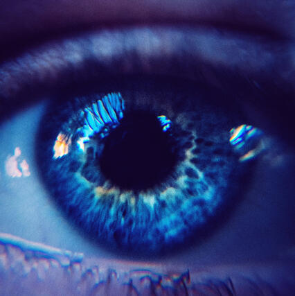 Metraxen - Iridology